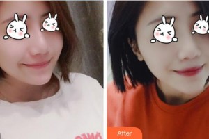 福建武警總隊(duì)醫(yī)院激光美容中心?？溯x整形價(jià)格表附無針?biāo)獍咐故?>
</a>
<h3 class=