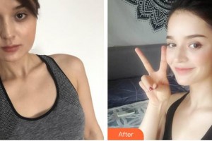 福州愛思特醫(yī)療美容醫(yī)院曾小梅整形價(jià)格表附激光美膚激光祛斑案例展示