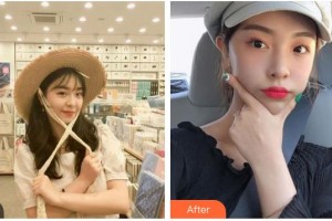 福州愛(ài)美爾整形美容醫(yī)院黃林勝整形價(jià)格表附抗衰老案例展示