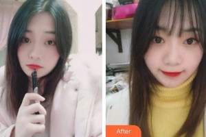 福州同福醫(yī)口腔門診部謝賢波整形價格表附牙齒矯正案例展示