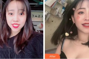 福州東南口腔醫(yī)院王一敏整形價格表附牙齒矯正案例展示