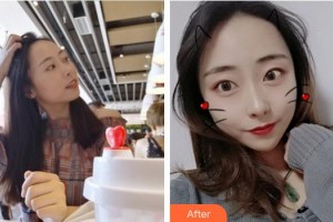 廈門海峽整形美容醫(yī)院易朝華整形價格表附熱瑪吉案例展示