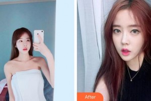 廈門蔡懿醫(yī)療美容診所李慧善整形價(jià)格表附鼻部手術(shù)案例展示