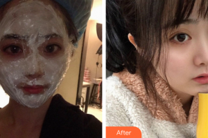 廣州博仕整形美容醫(yī)院劉亞光整形價(jià)格表附四代熱瑪吉案例展示