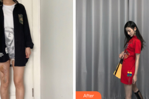 廣州廣大整形美容醫(yī)院賀芬整形價格表附增生疤痕案例展示