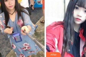 廈門大學附屬廈門眼科中心醫(yī)院伍端曉整形價格表附切開雙眼皮案例展示