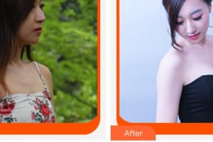 莆田海峽整形美容醫(yī)院田新海整形價(jià)格表附假體隆胸案例展示