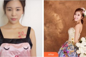 莆田少珍整形美容醫(yī)院祁少珍整形價(jià)格表附隆胸日記案例展示