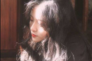 宜昌前衛(wèi)整形美容門診部王寶芬整形價(jià)格表附光子嫩膚案例展示