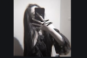 宜昌愛合口腔醫(yī)院張敏整形價(jià)格表附隱形托槽矯正案例展示