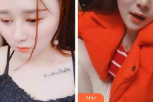 泉州西華醫(yī)療美容醫(yī)院張慧慧整形價(jià)格表附口腔案例展示