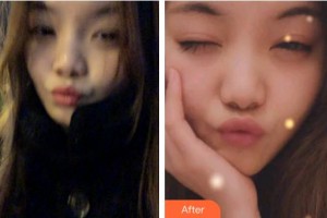 泉州泉興口腔門診部李家勝整形價(jià)格表附牙齒隱形矯正案例展示