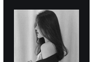 宜昌愛爾眼科醫(yī)院王國華整形價格表附切開雙眼皮案例展示