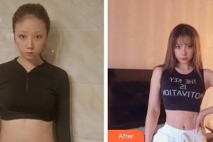 漳州市醫(yī)院整形美容科許和平整形價格表附疤痕案例展示