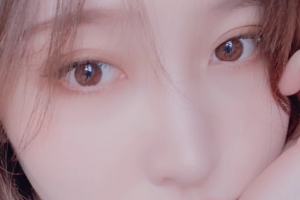 西安女子醫(yī)院醫(yī)學美容科張國孝整形價格表附面部吸脂案例展示