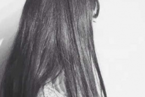 西安市第三人民醫(yī)院醫(yī)學整形美容中心沈剛民整形價格表附假體墊眉弓案例展示