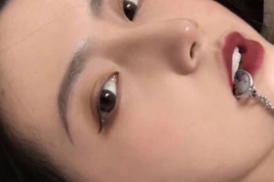 西安美立方整形美容醫(yī)院金寶玉整形價格表附面部吸脂案例展示