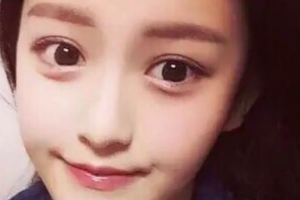 西安高一生醫(yī)療美容醫(yī)院高秀梅整形價格表附減脂案例展示