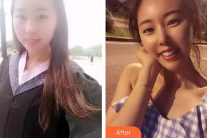 漳州衛(wèi)生職業(yè)學(xué)院附屬口腔醫(yī)院魏婷婷整形價(jià)格表附陶瓷矯正牙齒案例展示