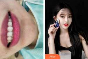 漳州南健口腔門診部田少惠整形價(jià)格表附牙齒矯正案例展示