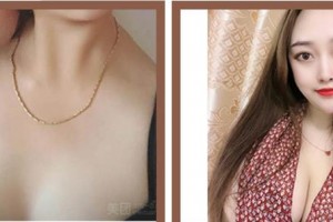 南平時(shí)光醫(yī)療美容門診部王召克整形價(jià)格表附隆胸案例展示