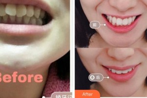 龍巖華美醫(yī)療美容醫(yī)院林才娘整形價(jià)格表附牙齒矯正案例展示