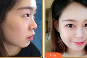 安徽立新醫(yī)學(xué)美容門診部黃海彬整形價格表附眼部多項案例展示