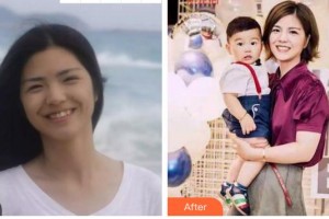 安徽天鵝湖口腔醫(yī)院張鵬整形價格表附牙齒矯正案例展示