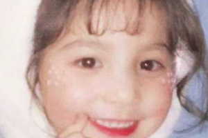 西安艾薇美醫(yī)療美容門診部張濤整形價格表附埋線提升案例展示