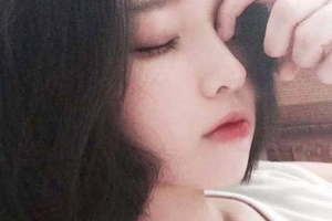 西安鵬愛悅己醫(yī)療美容門診部關鍵整形價格表附激光祛斑案例展示