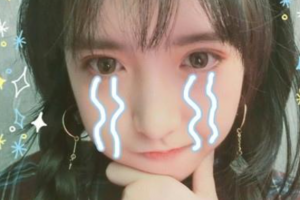 西安高新醫(yī)院整形外科張龍整形價(jià)格表附超聲提拉案例展示