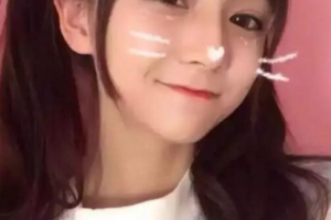 西安新銳植發(fā)醫(yī)療美容門診部張宗雨整形價(jià)格表附種植發(fā)際線案例展示