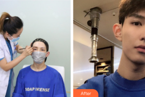 廣州伊麗莎白醫(yī)學(xué)美容門診部金藝元整形價格表附種植眉毛案例展示