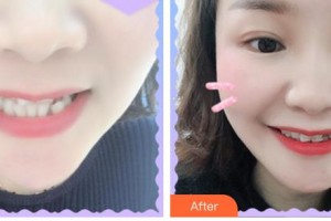 合肥麗人女子醫(yī)院中韓整形美容中心吳艷玲整形價(jià)格表附牙齒矯正案例展示