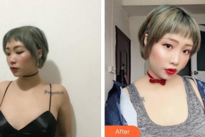 合肥麗人女子醫(yī)院中韓整形美容中心姜哲順整形價格表附自體脂肪隆胸案例展示