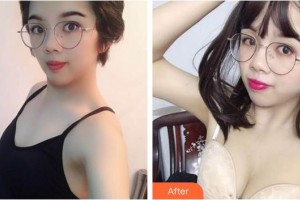 合肥大韓整形美容醫(yī)院楊軍叢整形價格表附自體脂肪隆胸案例展示