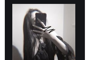 西安小白兔口腔醫(yī)院段紅紅整形價格表附金屬托槽矯正案例展示