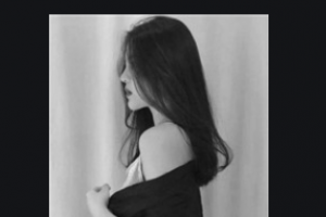 西安小白兔口腔醫(yī)院閆慧娟整形價格表附牙齒陶瓷矯正案例展示