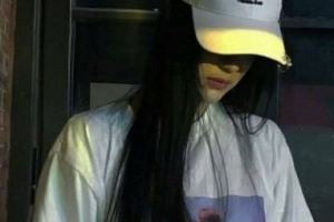 西安小白兔口腔醫(yī)院張俊霞整形價格表附牙貼面案例展示