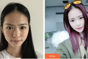 合肥壹加壹整形美容醫(yī)院柳春洙整形價(jià)格表附抗衰老案例展示