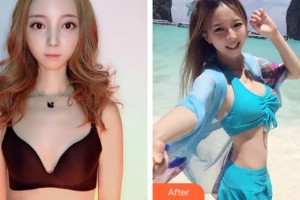 合肥壹美尚美容醫(yī)院李艷東整形價格表附自體脂肪隆胸案例展示