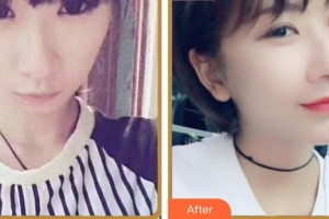 合肥名人眼科醫(yī)院曾令輝整形價格表附眼部綜合案例展示