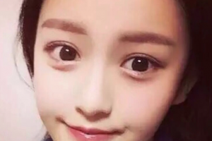 長沙臻顏醫(yī)療美容門診部張浩整形價格表附激光祛斑案例展示