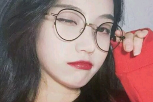 長沙藝星醫(yī)學美容醫(yī)院金恩秀整形價格表附埋線提升案例展示