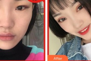 合肥愛爾眼科醫(yī)院劉平整形價格表附眼修復案例展示