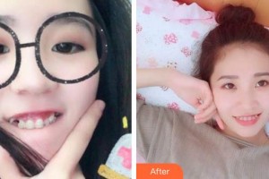 合肥瑞特曼口腔門診部金多貴整形價(jià)格表附牙齒矯正案例展示