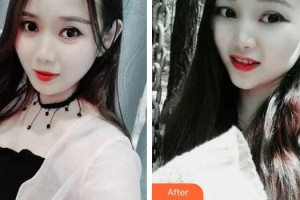 合肥佳德口腔門診部王炳節(jié)整形價(jià)格表附牙齒矯正案例展示