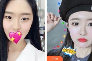 蕪湖華美醫(yī)療美容診所高翠蘭整形價格表附眼部整形案例展示