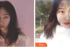 蕪湖眼科醫(yī)院（弋江區(qū)醫(yī)院）汪亮整形價格表附切開雙眼皮案例展示