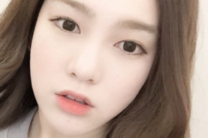 長沙愛思特醫(yī)療美容醫(yī)院Coco整形價格表附耳軟骨復合隆鼻案例展示